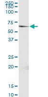 Anti-P4HB Rabbit Polyclonal Antibody