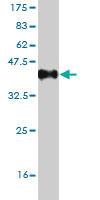 Anti-CLCA1 Mouse Monoclonal Antibody [clone: 2C10]