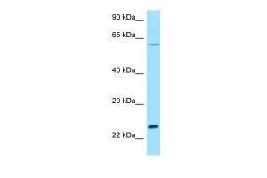 Anti-RAC2 Rabbit Polyclonal Antibody