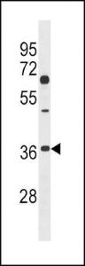 Anti-Dkk-2 CT Rabbit Polyclonal Antibody (AP (Alkaline Phosphatase))