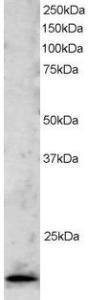 Anti-TBPL1 Antibody (A83875) staining (2 µg/ml) of Jurkat lysate (RIPA buffer, 30 µg total protein per lane). Primary incubated for 1 hour. Detected by western blot using chemiluminescence