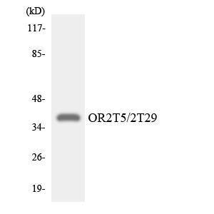 Anti-OR2T5 and OR2T29 antibody