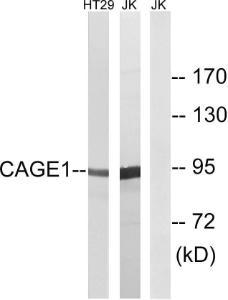 Western blot analysis of lysates from HT-29 and Jurkat cells using Anti-CAGE1 Antibody. The right hand lane represents a negative control, where the antibody is blocked by the immunising peptide.