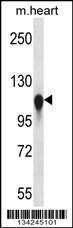 Anti-KIF5C Rabbit Polyclonal Antibody (HRP (Horseradish Peroxidase))