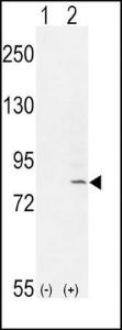 Anti-FGFR1-Y307 Rabbit Polyclonal Antibody (AP (Alkaline Phosphatase))