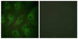 Immunofluorescence analysis of HeLa cells using Anti-Kir6.2 Antibody. The right hand panel represents a negative control, where the antibody was pre-incubated with the immunising peptide.