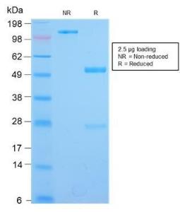 SDS-PAGE analysis of Anti-IL3RA Antibody [IL3RA/2947R] under non-reduced and reduced conditions; showing intact IgG and intact heavy and light chains, respectively. SDS-PAGE analysis confirms the integrity and purity of the antibody.