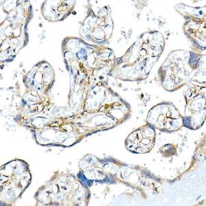 Immunohistochemistry analysis of paraffin-embedded human placenta using Anti-Podoplanin / gp36 Antibody (A305444) at a dilution of 1:20 (40x lens). Perform high pressure antigen retrieval with 10 mM citrate buffer pH 6.0 before commencing with IHC staining protocol.