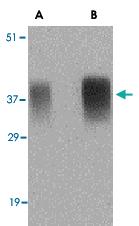 Anti-APH1 Rabbit Polyclonal Antibody