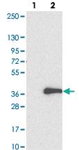 Anti-C10ORF22 Rabbit Polyclonal Antibody