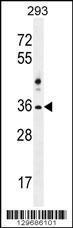 Anti-NKX1-2 Rabbit Polyclonal Antibody