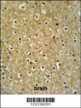 Anti-CIRH1A Rabbit Polyclonal Antibody (FITC (Fluorescein Isothiocyanate))