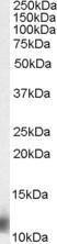 Anti-RPS27 antibody