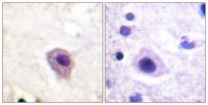 Immunohistochemical analysis of paraffin-embedded human brain using Anti-DRP-2 (phospho Thr514) Antibody The right hand panel represents a negative control, where the antibody was pre-incubated with the immunising peptide