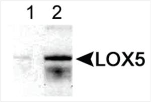 Anti-Lipoxygenase, 5- Rabbit Polyclonal Antibody