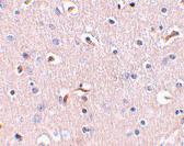 Anti-APH1 Rabbit Polyclonal Antibody