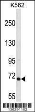 Anti-ARHGEF6 Rabbit Polyclonal Antibody (HRP (Horseradish Peroxidase))