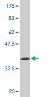 Anti-FAS Mouse Monoclonal Antibody [clone: 3D7]