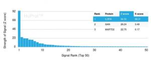 Analysis of protein array containing more than 19,000 full-length human proteins using Anti-IL3RA Antibody [IL3RA/2947R