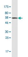 Anti-NPM2 Mouse Monoclonal Antibody [clone: 5E9]