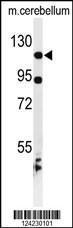 Anti-KIF6 Rabbit Polyclonal Antibody (Biotin)