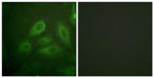 Immunofluorescence analysis of HeLa cells using Anti-DRP-2 (phospho Thr514) Antibody The right hand panel represents a negative control, where the antibody was pre-incubated with the immunising peptide