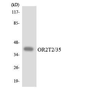 Western blot analysis of the lysates from HeLa cells using Anti-OR2T2 + OR2T35 Antibody