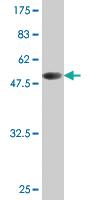 Anti-TK1 Mouse Monoclonal Antibody [clone: 1D10]