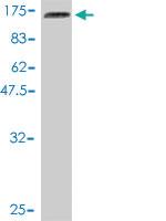 Anti-BUB1 Mouse Monoclonal Antibody [clone: 4C3-4C9]