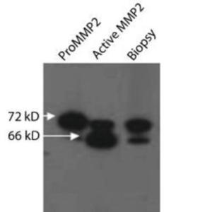 Anti-Matrix Metalloproteinase 2 Mouse Monoclonal Antibody [clone: 8L686]