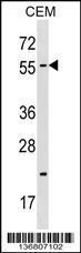 Anti-CBX4 Rabbit Polyclonal Antibody (AP (Alkaline Phosphatase))