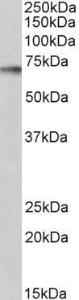 Anti-P70 S6 Kinase alpha Goat Polyclonal Antibody