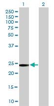 Anti-GSTT2 Mouse Polyclonal Antibody