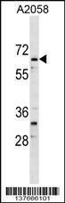 Anti-ARID5A Rabbit Polyclonal Antibody (Biotin)