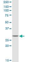 Anti-GSTT2 Rabbit Polyclonal Antibody