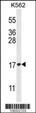 Anti-HIST3H3 Rabbit Polyclonal Antibody (PE (Phycoerythrin))