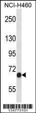 Anti-FGFR1 Rabbit Polyclonal Antibody (AP (Alkaline Phosphatase))