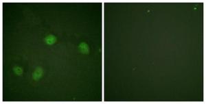 Immunofluorescence analysis of HeLa cells using Anti-C-RAF (phospho Ser621) Antibody. The right hand panel represents a negative control, where the Antibody was pre-incubated with the immunising peptide