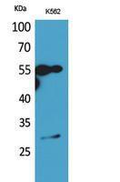 Western blot analysis of extracts from K562 cells using Anti-MS4A1 Antibody