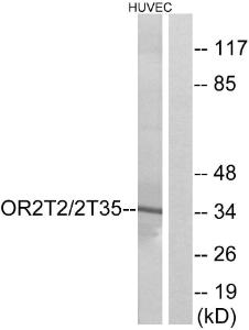 Anti-OR2T2 + OR2T35 Rabbit Polyclonal Antibody