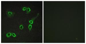 Immunofluorescence analysis of COS7 cells using Anti-C3AR1 Antibody. The right hand panel represents a negative control, where the antibody was pre-incubated with the immunising peptide