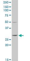 Anti-GSTT2 Rabbit Polyclonal Antibody