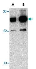 Anti-RPAIN Rabbit Polyclonal Antibody