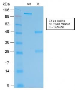 SDS-PAGE analysis of Anti-HCG beta Antibody [rHCGb/54] under non-reduced and reduced conditions; showing intact IgG and intact heavy and light chains, respectively. SDS-PAGE analysis confirms the integrity and purity of the antibody.