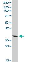 Anti-GSTT2 Rabbit Polyclonal Antibody