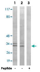 Anti-CDK5 Rabbit Polyclonal Antibody