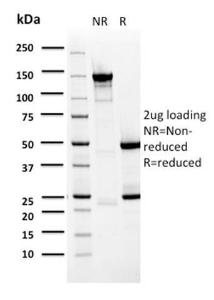 Anti-BARX1 Mouse Monoclonal Antibody [clone: BARX1/2759]