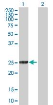 Anti-GSTT2 Rabbit Polyclonal Antibody