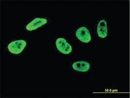 Anti-CDK12 Mouse Monoclonal Antibody [clone: 3C1]