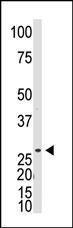 Anti-DKKL1 Rabbit polyclonal antibody